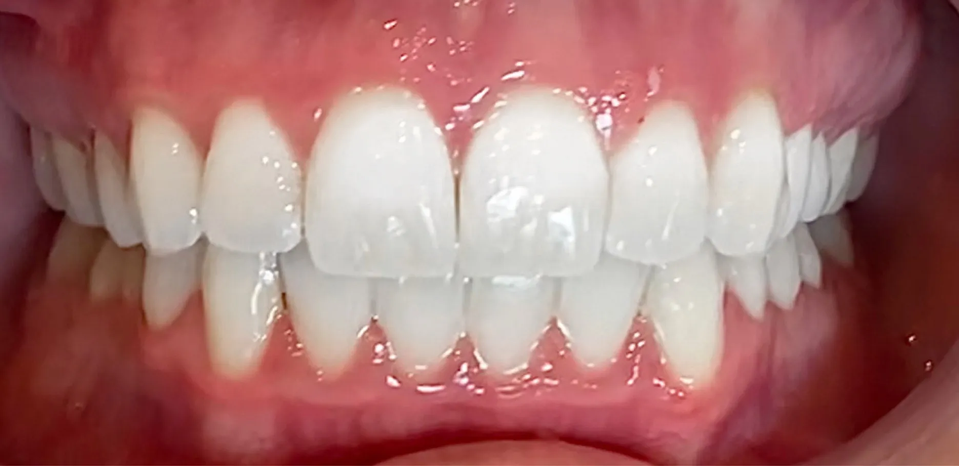 /img/26992-bright-smile.webp
