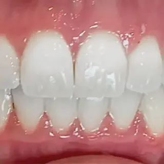 /img/26992-bright-smile.webp