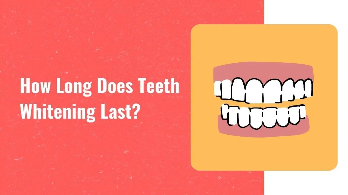 26992 professional teeth whitening