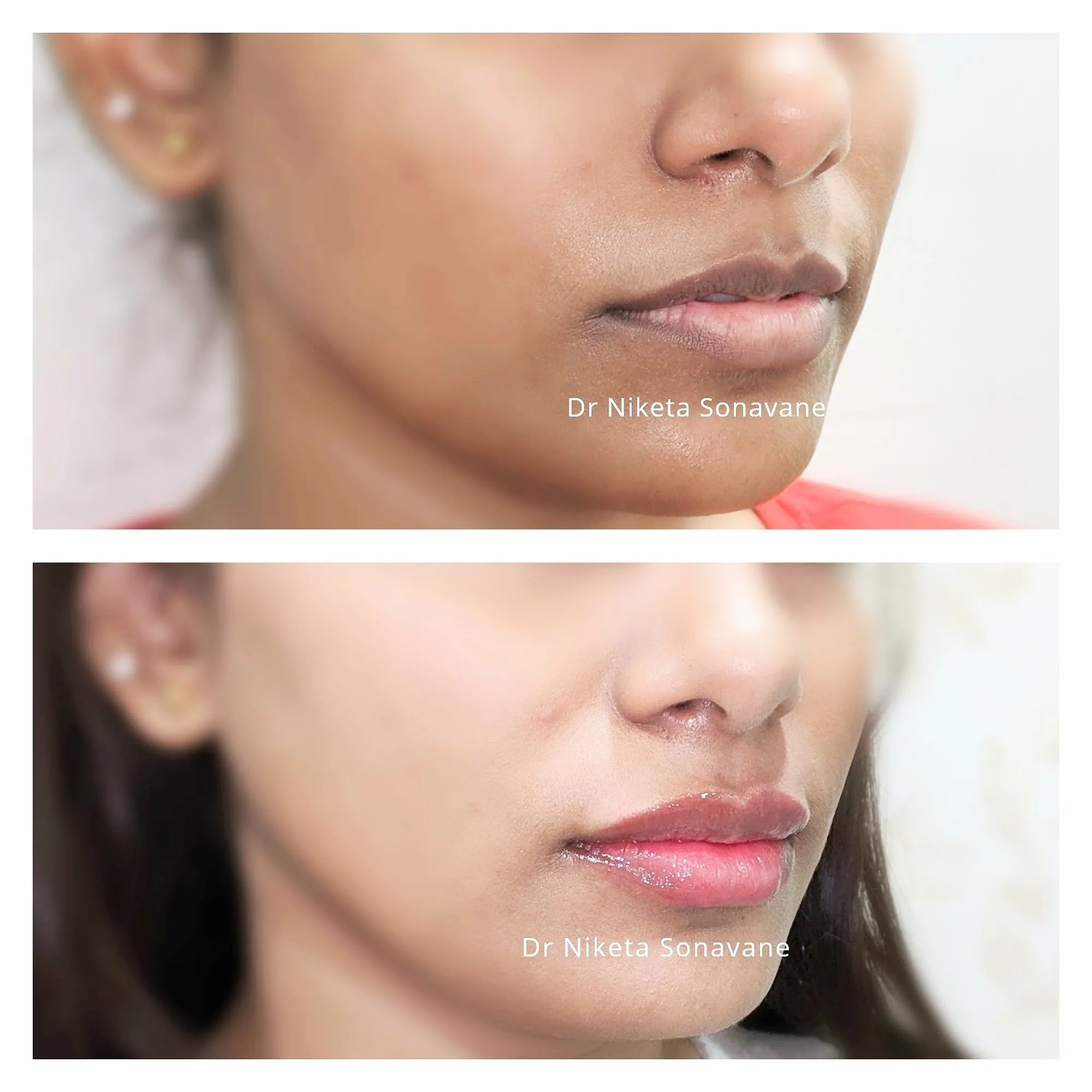 26995 skin whitening masks