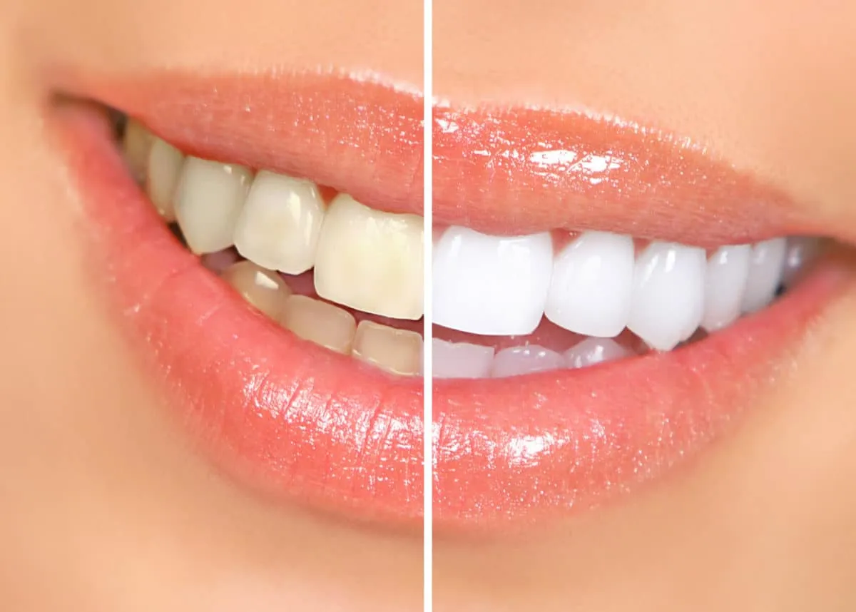 26997 dental checkups phoenix