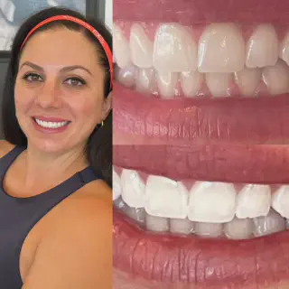 /img/26997-teeth-whitening-cost.webp