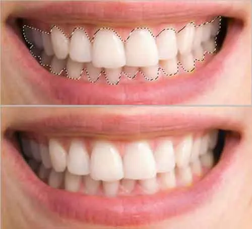 26998 photoshop express teeth whitening hero