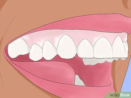 27001 choosing whitening strips