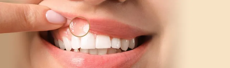 27001 identifying white gums