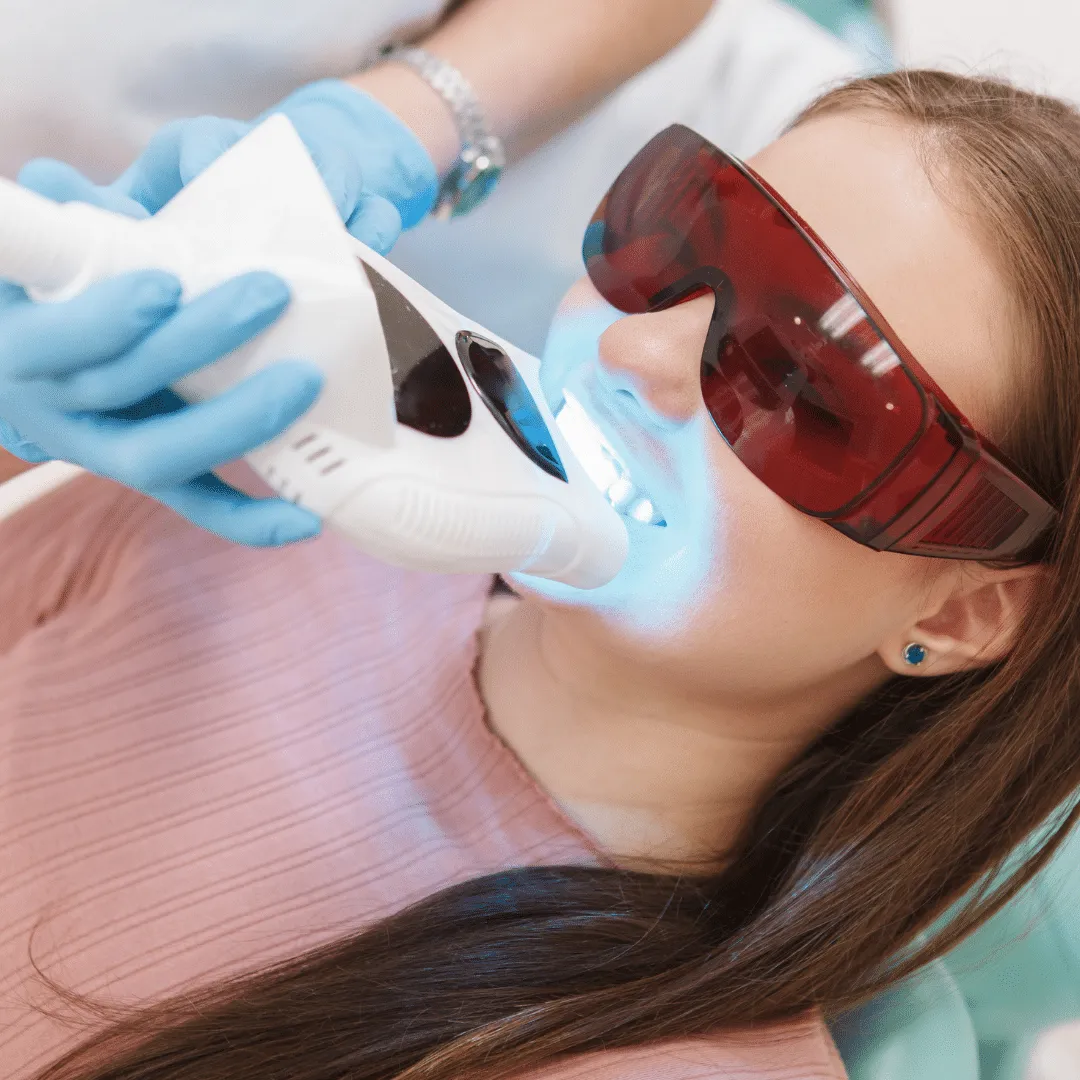 27005 zoom whitening houston tx cost