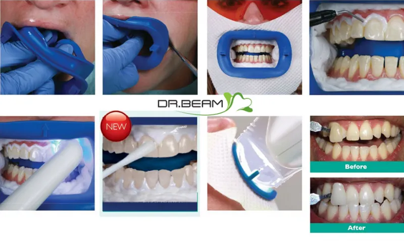 27005 zoom whitening houston tx dentist
