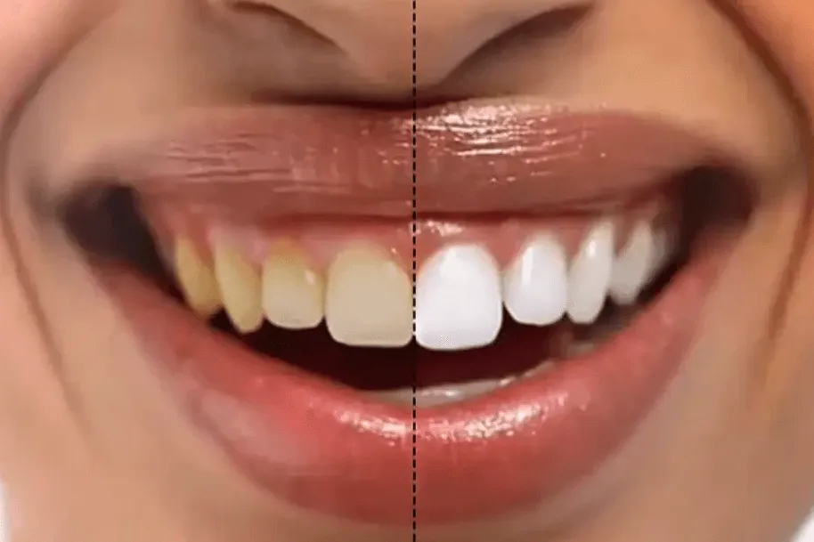 27006 flossing teeth