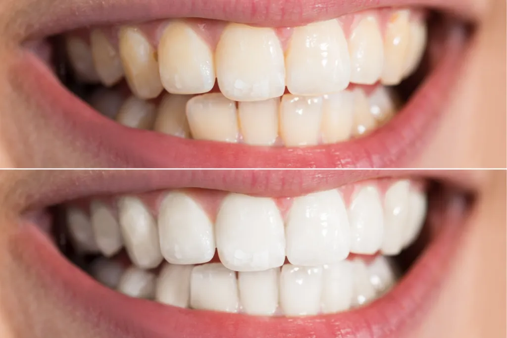 27007 healthy smile