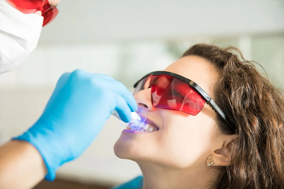 /img/27007-teeth-whitening-results.webp