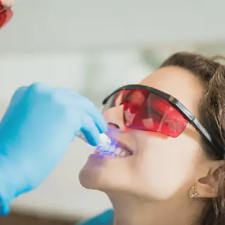 /img/27007-teeth-whitening-results.webp