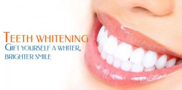 27008 teeth whitening klerksdorp at home