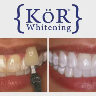 /img/27008-teeth-whitening-klerksdorp-confidence.webp