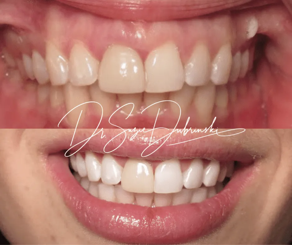 27008 teeth whitening klerksdorp professional