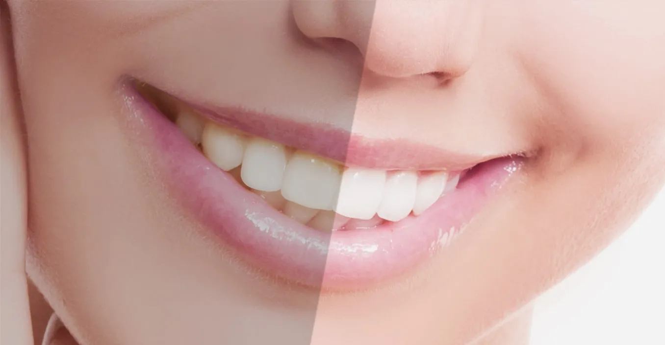 /img/27010-healthy-smile.webp