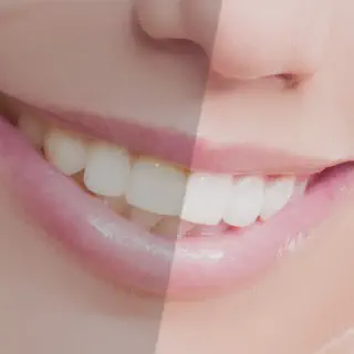 /img/27010-healthy-smile.webp