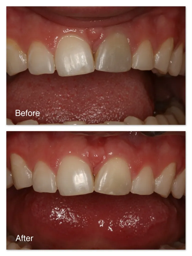 27011 maintaining white smile