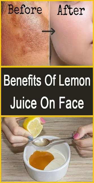 /img/27013-lemon-juice-application.webp