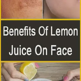 /img/27013-lemon-juice-application.webp
