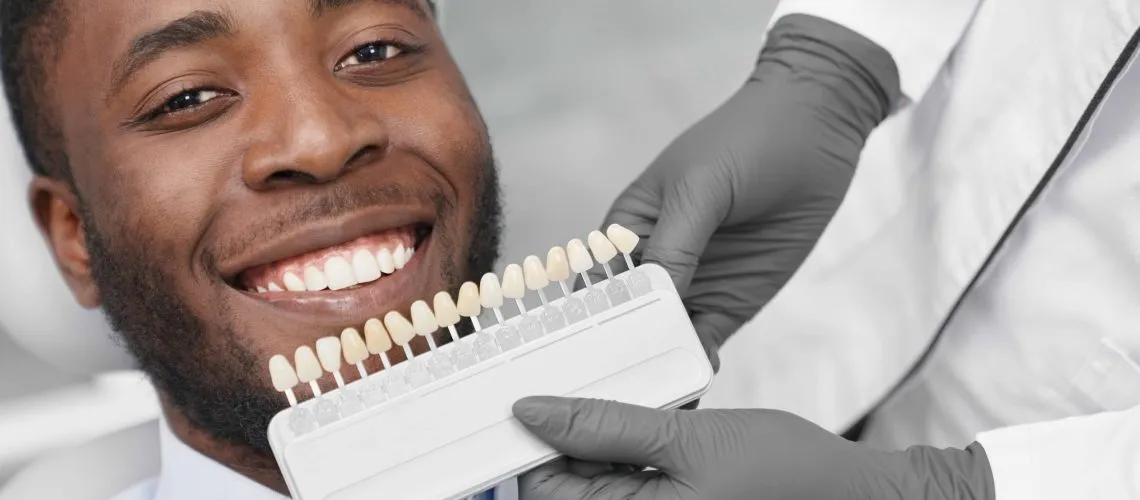27014 in office teeth whitening