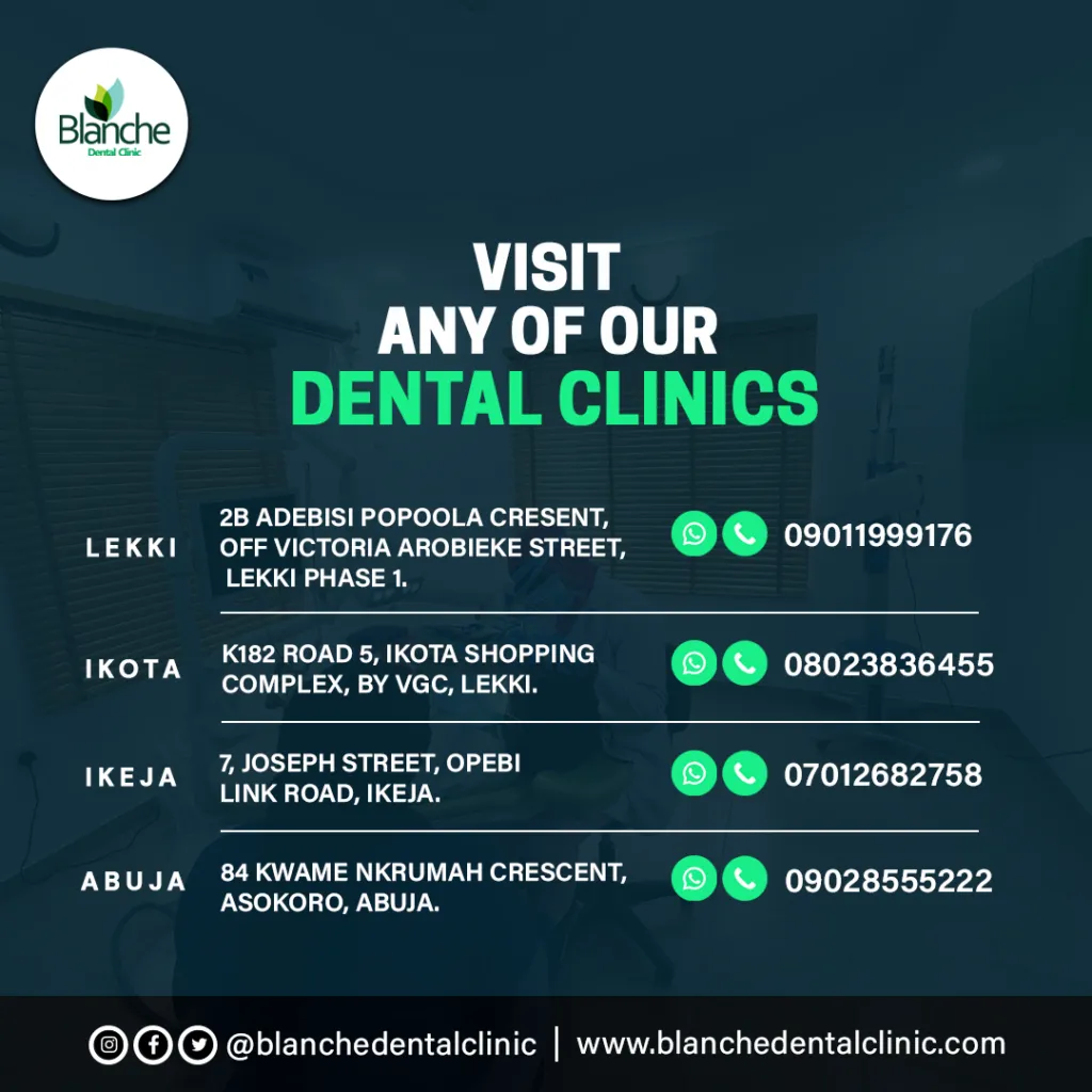 /img/27014-teeth-whitening-nairobi-cost-comparison.webp