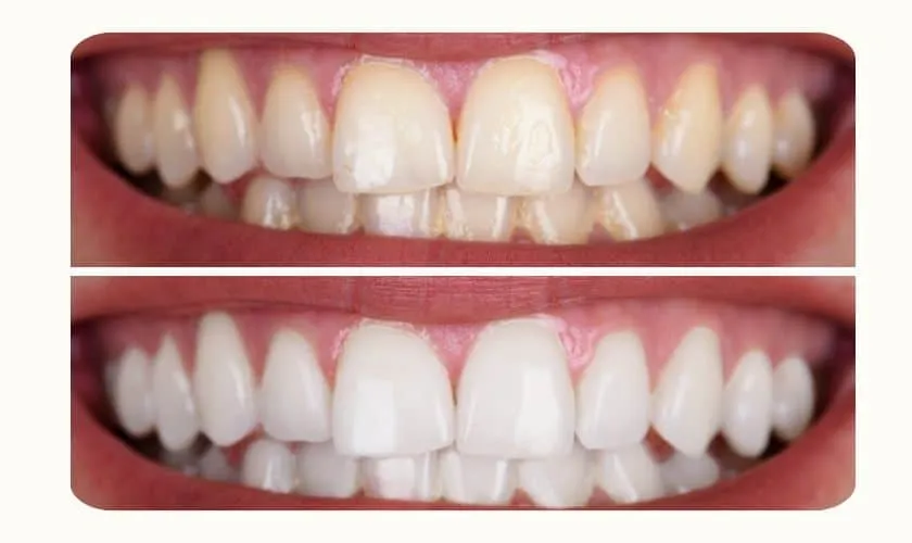 27017 regular dental checkup