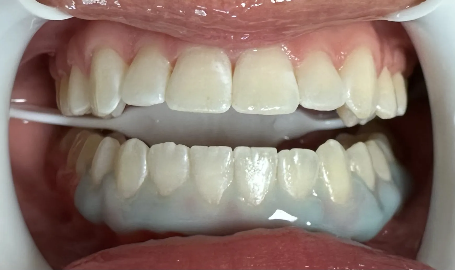 /img/27019-dental-checkup.webp