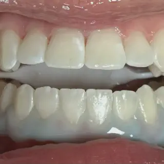 /img/27019-dental-checkup.webp
