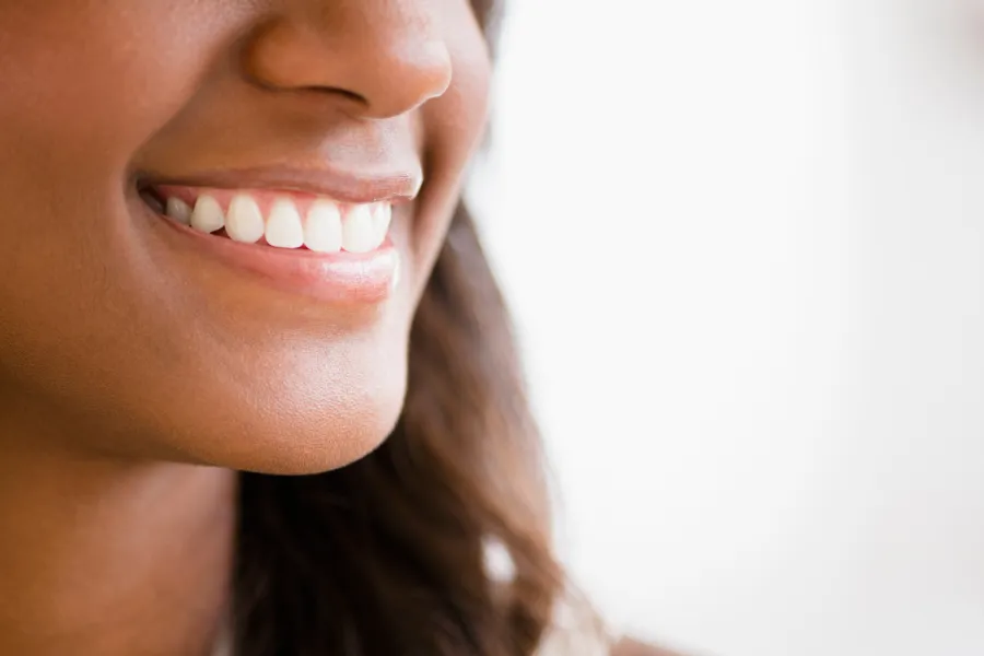 27022 whitening strips