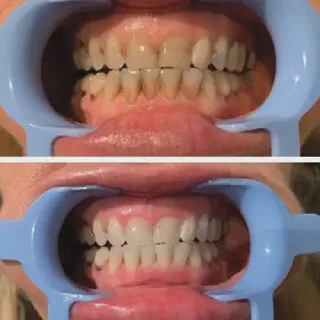 /img/27023-maintain-oral-hygiene.webp