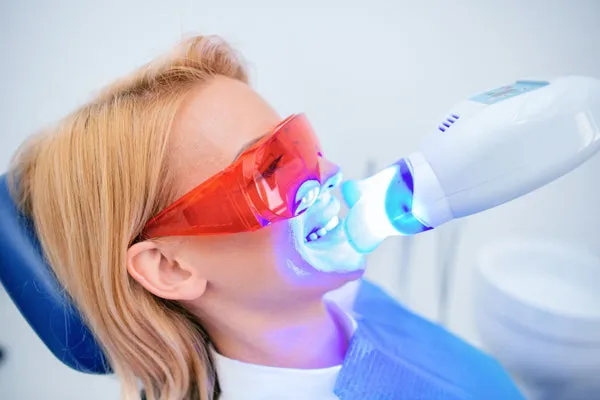 27027 compare teeth whitening prices