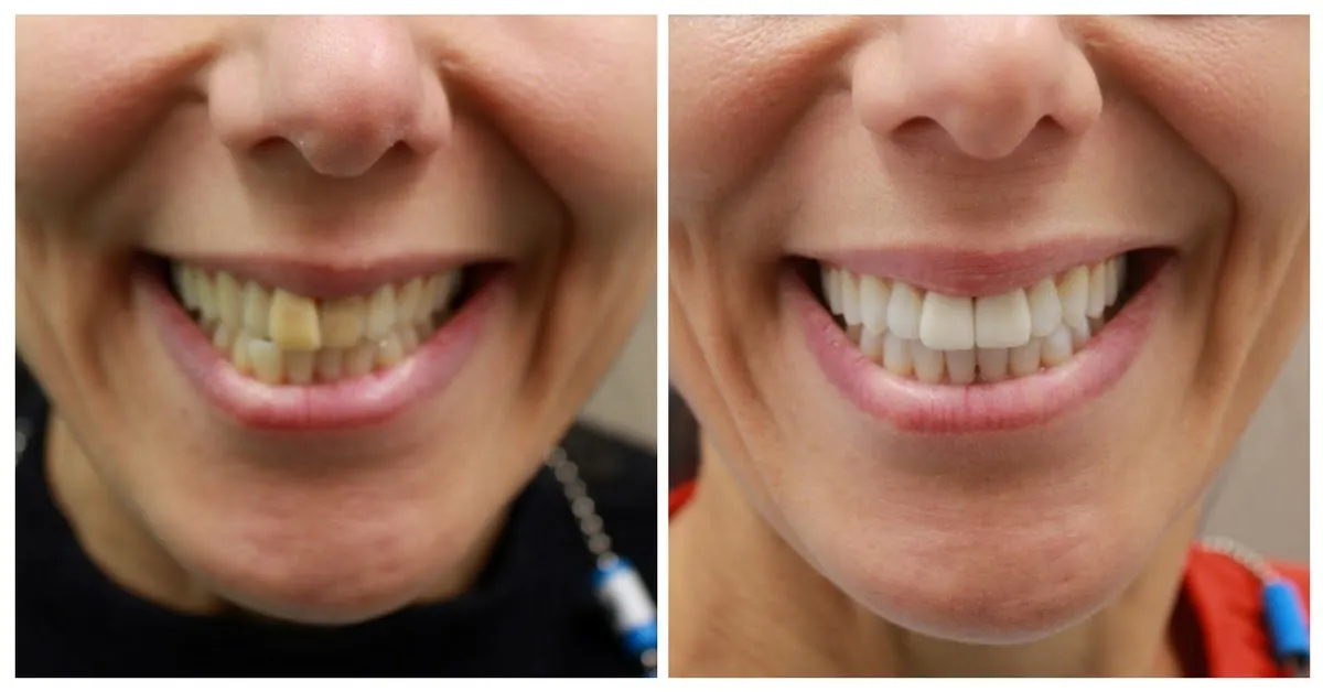 /img/27027-regular-dental-checkups.webp