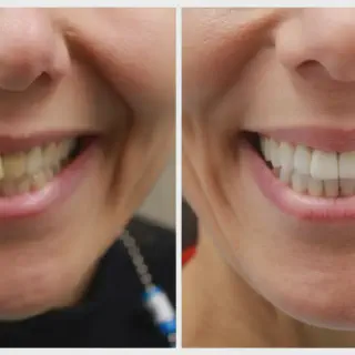 /img/27027-regular-dental-checkups.webp