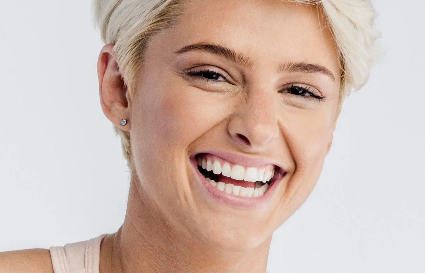 27028 oral hygiene after whitening