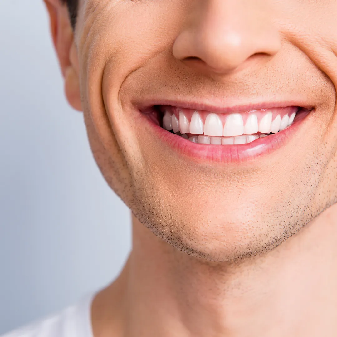 27029 at home teeth whitening