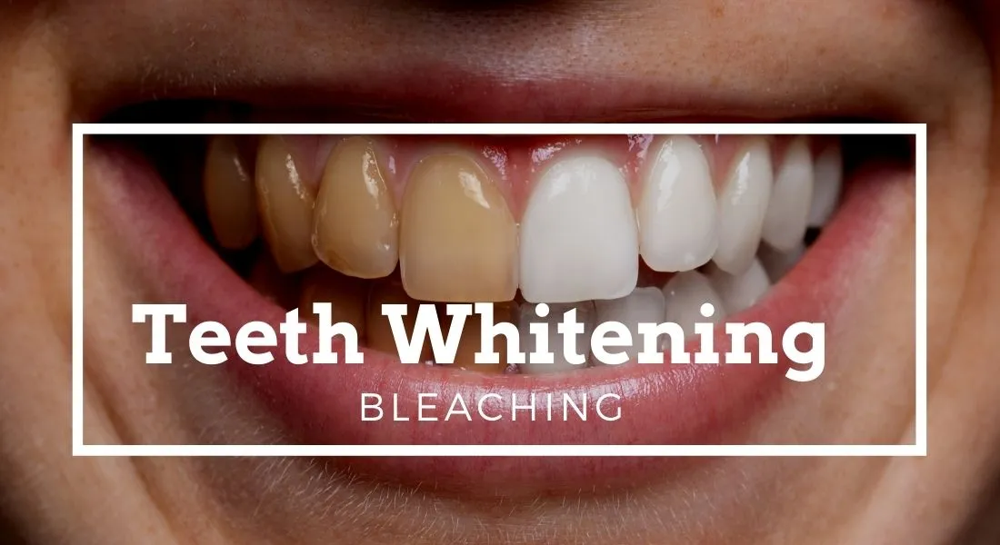 /img/27029-dental-consultation.webp