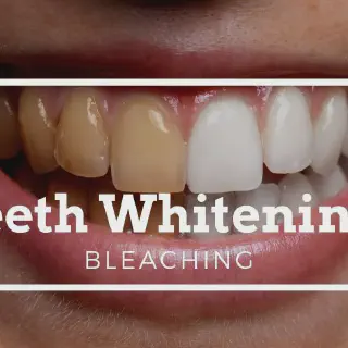 /img/27029-dental-consultation.webp