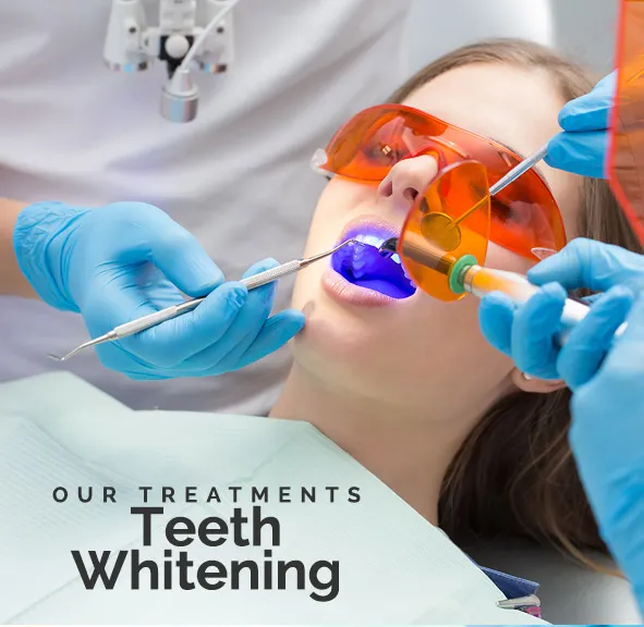 27034 teeth whitening philly 7