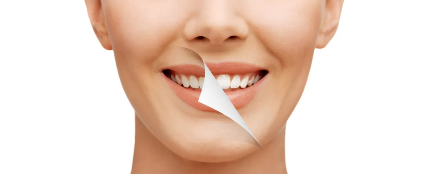 27035 lavinso teeth whitening easy application