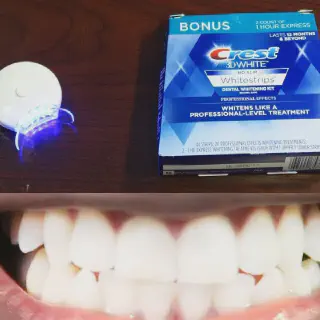 /img/27037-teeth-whitening-at-home.webp