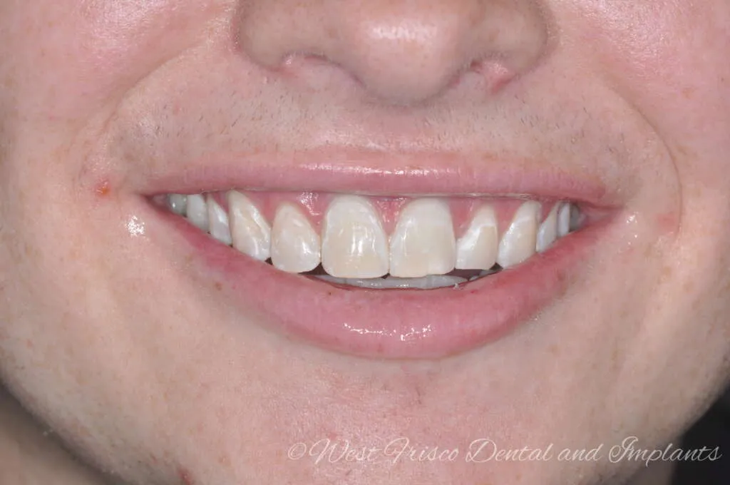 /img/27039-dental-checkup.webp