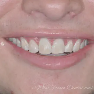 /img/27039-dental-checkup.webp