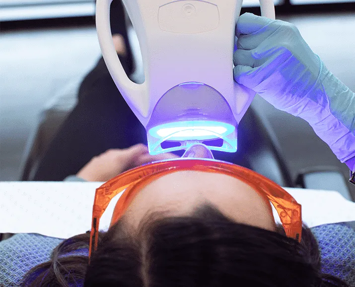 27039 teeth whitening maintenance