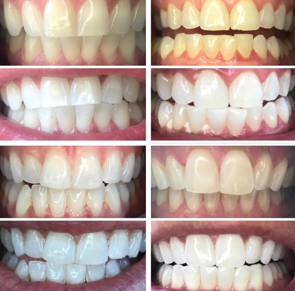 27040 dental hygiene