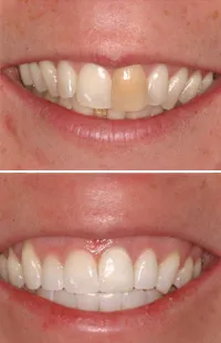 /img/27040-smiling-woman.webp