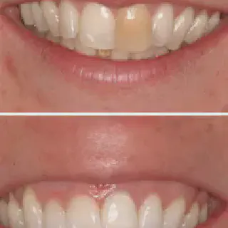 /img/27040-smiling-woman.webp