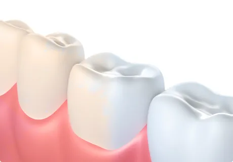 27040 teeth whitening options