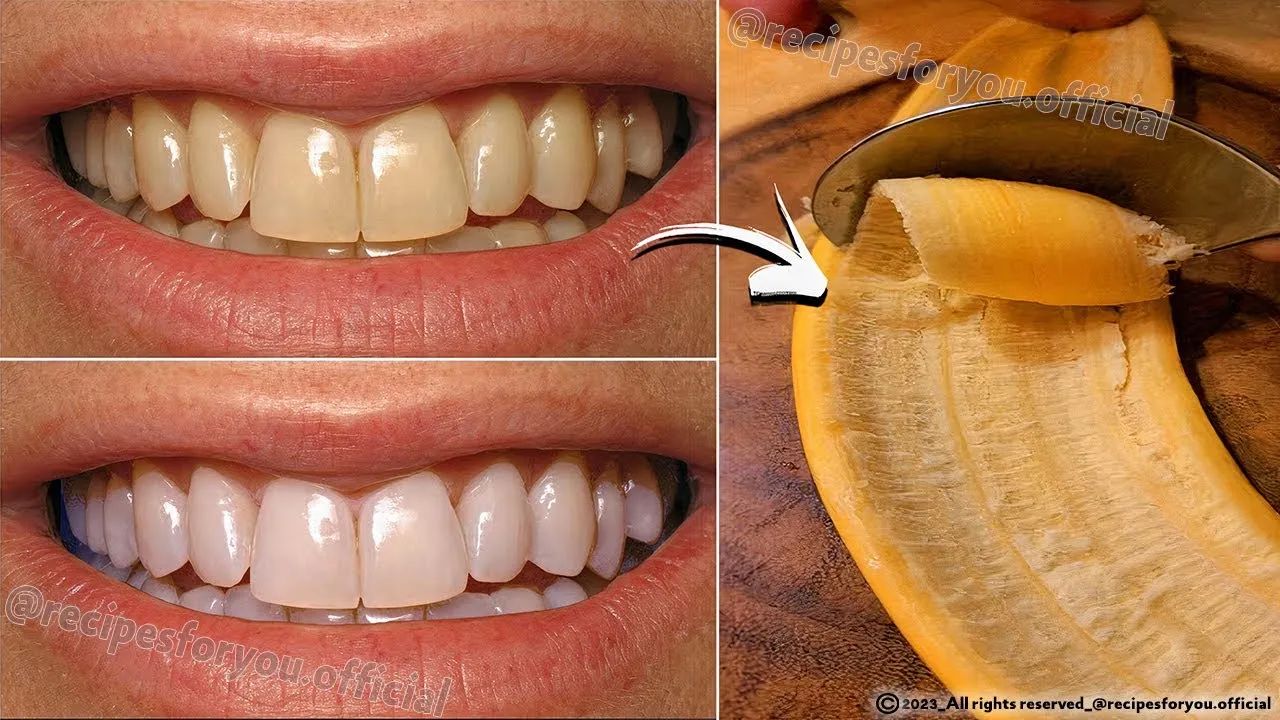 /img/27049-banana-peel-teeth-whitening-7.webp