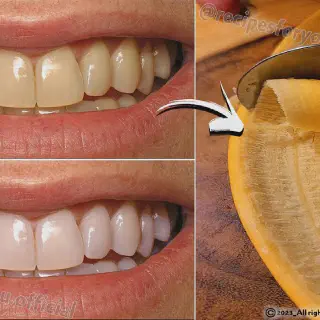 /img/27049-banana-peel-teeth-whitening-7.webp