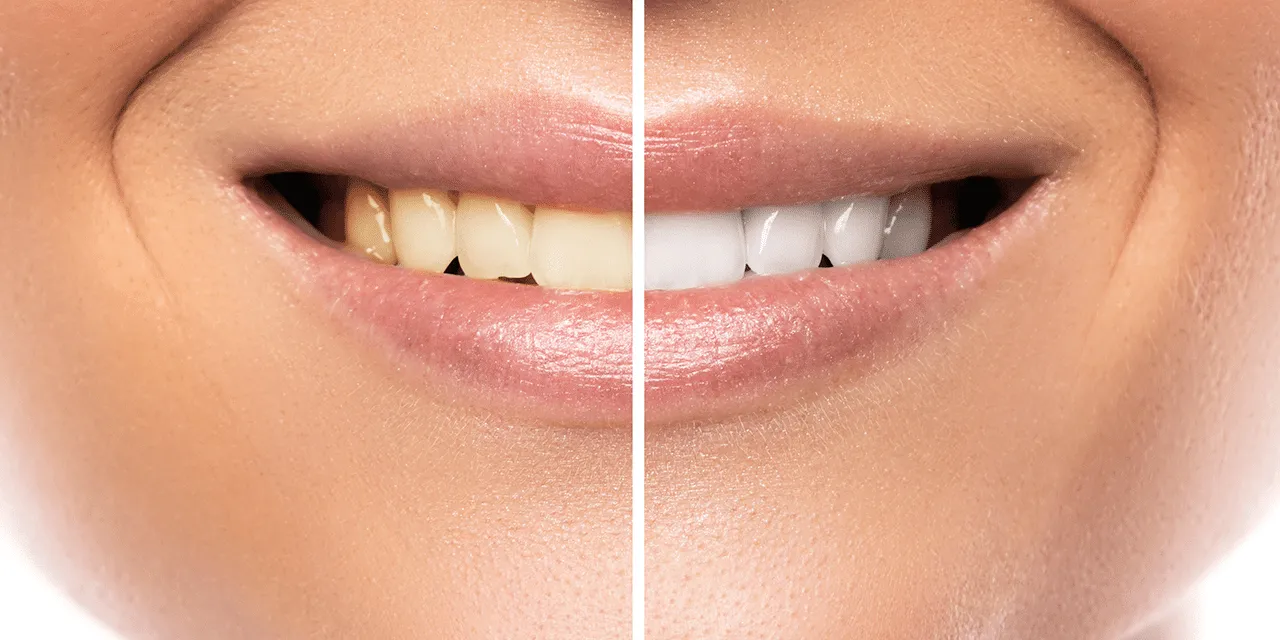 27050 healthy smile